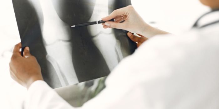 Carenza di vitamina D